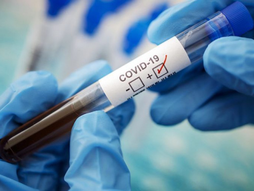 Коронавірус: +35 нових випадків виявили у Кривому Розі