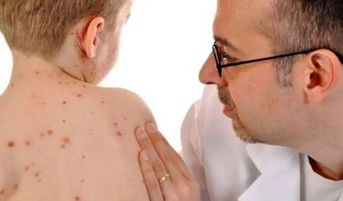 Кір на Дніпропетровщині, фото з відкритих джерел 