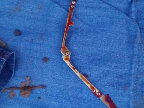 День рыбака по-криворожски: во время конфликта между мужчинами в Кривом Роге в ход пошли рыболовные снасти