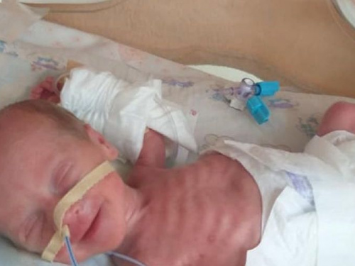 Крохотных девочек-двойняшек из Кривого Рога, родившихся весом менее килограмма, перевели из реанимации (фото)