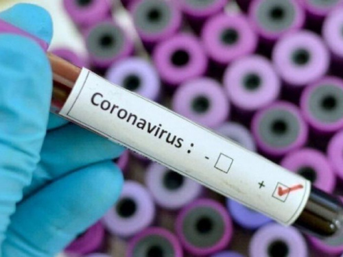 На Дніпропетровщині виявили ще 7 випадків коронавірусної хвороби