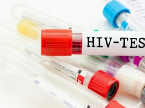 Днепропетровская область оказалась лидером по заболеванию ВИЧ