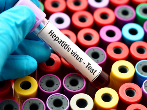 Тестування на вірусні гепатити, фото з відкритих джерел 