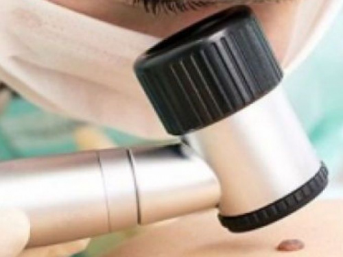 Криворожане могут пройти бесплатное обследование на меланому