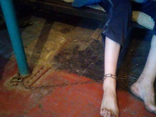 На Днепропетровщине родственники держали на цепи ради выплат мужчину с инвалидностью