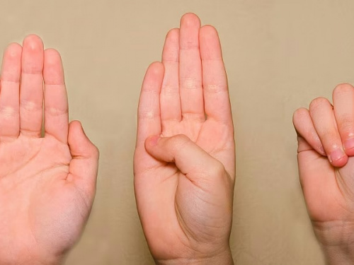 Жест порятунку, фото з відкритих джерел 