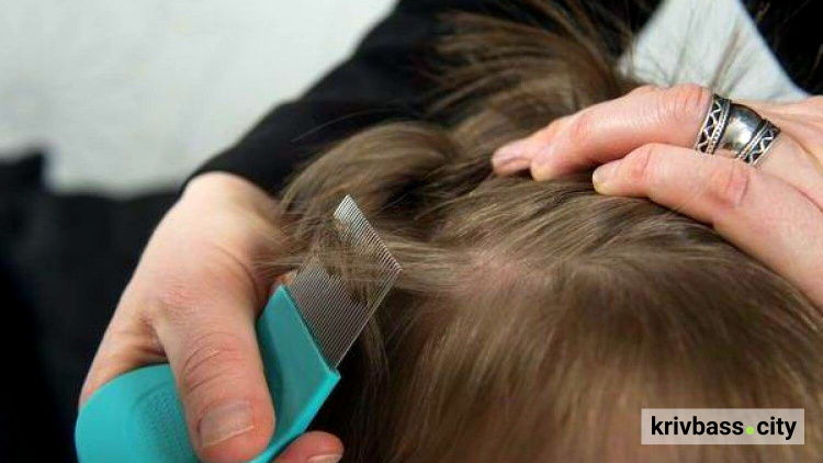 Небажані сусіди: що потрібно знати та як вберегтися від педикульозу