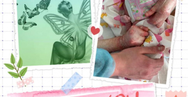 На Днепропетровщине "женщина-бабочка" с тяжелейшим диагнозом родила здорового ребенка