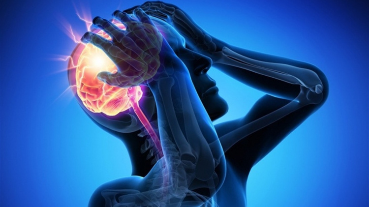 Як вчасно розпізнати інсульт і врятувати життя - фото з відкритих джерел