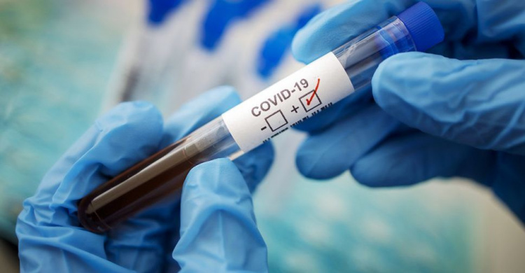 Коронавірус: +35 нових випадків виявили у Кривому Розі