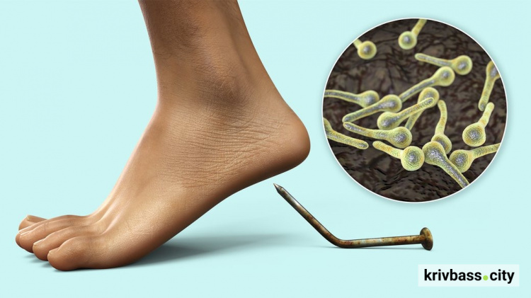 Вакцина могла врятувати: на Дніпропетровщині дитина померла від правця