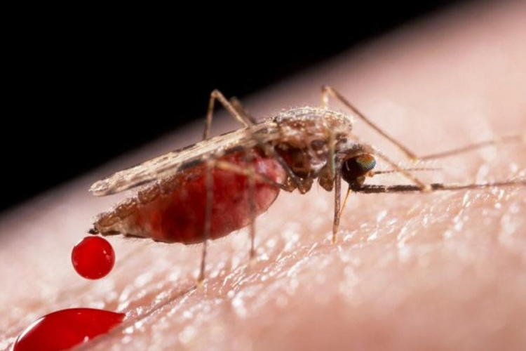 малярія в Україні, фото з відкритих джерел 