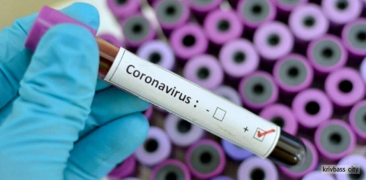 На Дніпропетровщині виявили нові випадки коронавірусної інфекції - ОДА